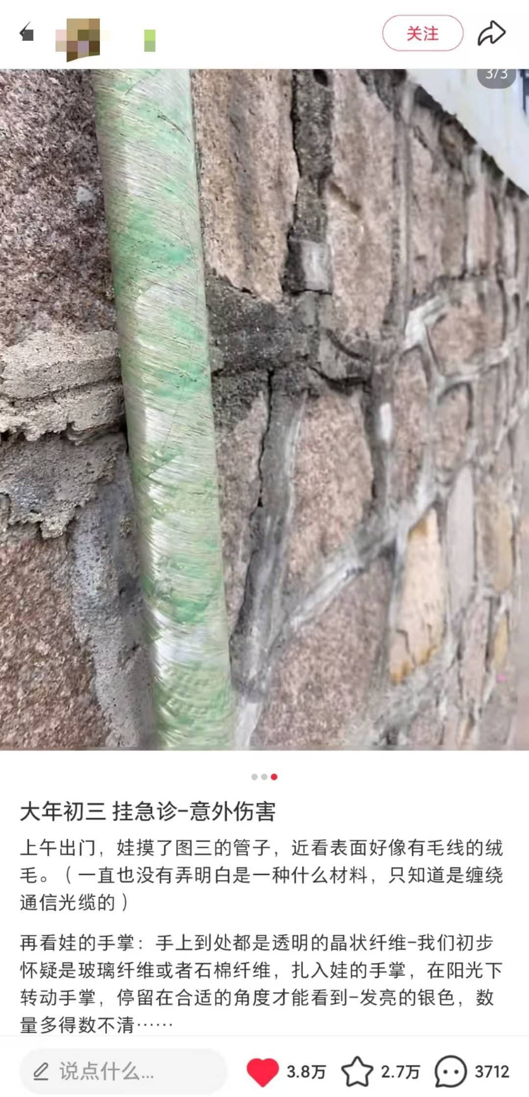 小孩被玻璃纤维扎伤，医院无法全部取出，这种“隐形杀手”你家里有吗？