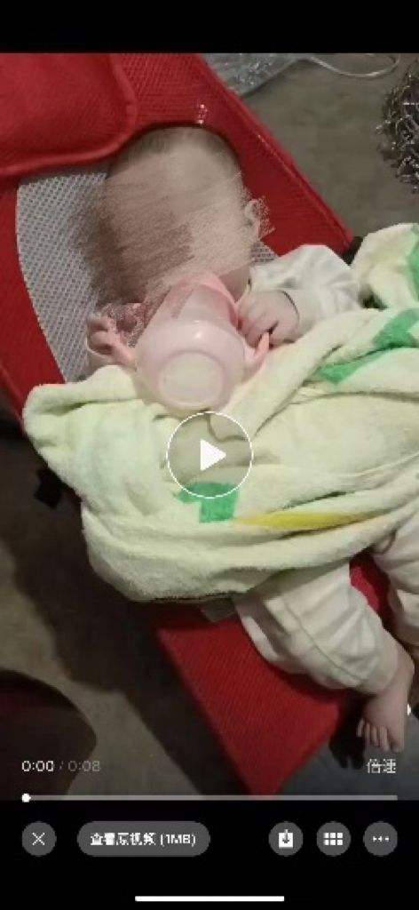 8个月女婴被饿成皮包骨住进重症监护室，当地回应：未发现虐待